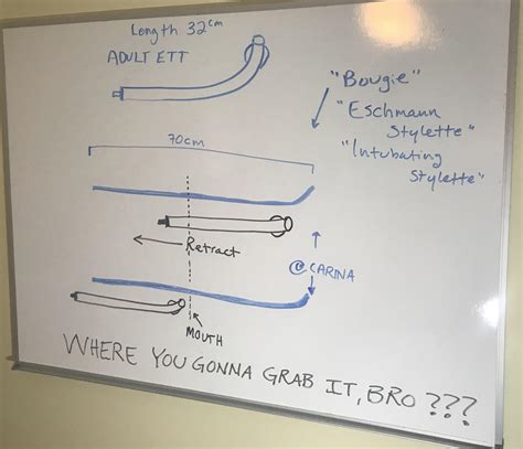 airway exchange catheter vs bougie.